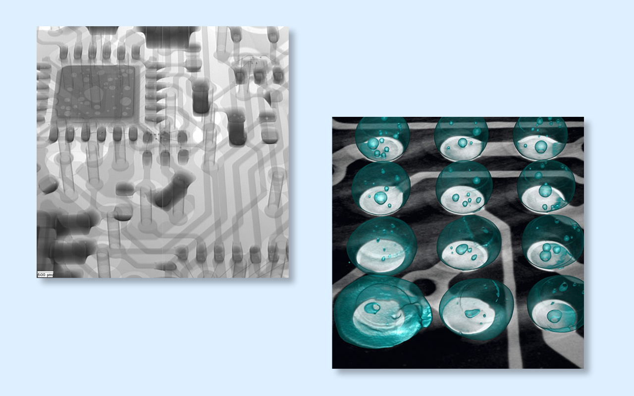 4. 2D vs 3D CT X-ray Which One Do You Really Need? 4. Rontgen CT 2D vs 3D Mana yang Benar-Benar Anda Butuhkan?