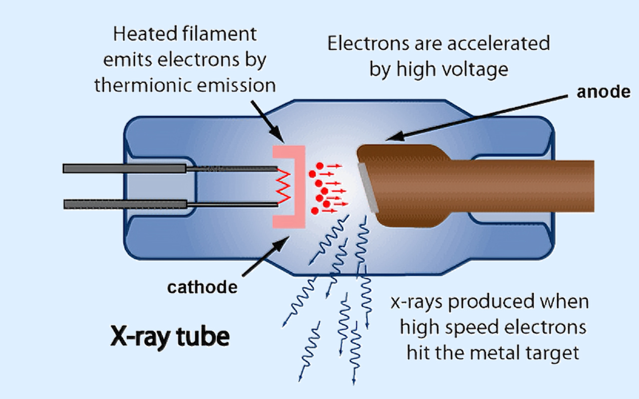 2. What X-ray Technology Actually Does 2. Apa Fungsi Sebenarnya Teknologi Sinar-X